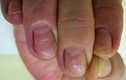 Tin bác sĩ bệnh viện lớn, người đàn ông tiêu chảy suýt chết